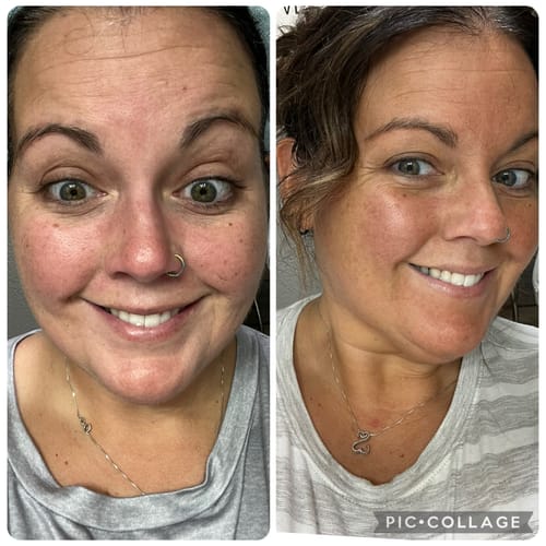 Customer photo review of Sunny Girl Face Tanning Mist