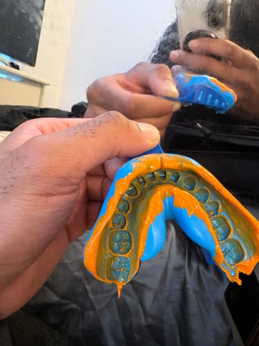 Customer photo review of Upper & Lower Impression Kit