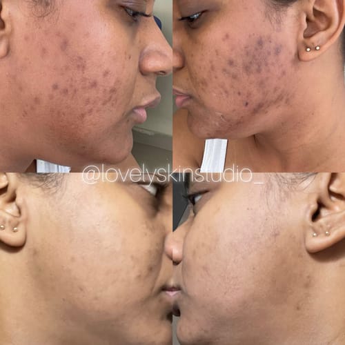 Customer photo review of Zena 100% Organic Algae Peel