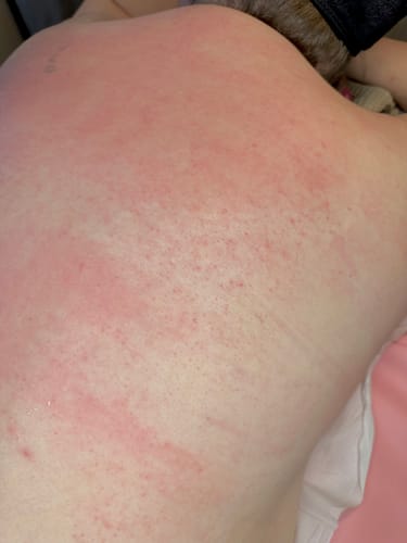 Customer photo review of Plumeria Hard Wax 1kg