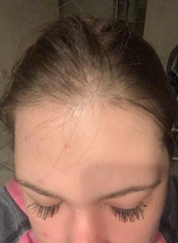 Customer photo review of PACHET DE TRANSFORMARE DREAM LASH