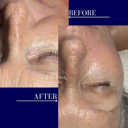 Customer photo review of Zena ExoBoost Ampoules