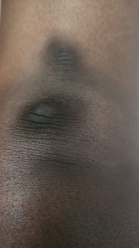 Customer photo review of Bright Skin Bish