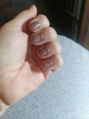 Hand einer Kundin, die die „Marble Waves“-Nagelfolien nach 10 Tagen Tragezeit zeigt, mit sichtbarem Nagelwachstum.