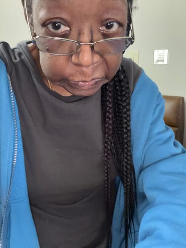 Customer photo review of Semaglutide Lite Program