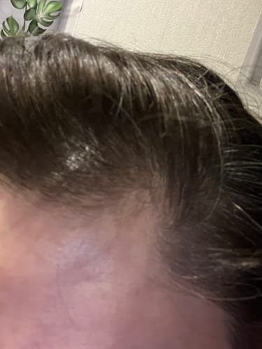 Customer photo review of Cell Happy Co - Toner anti-chute de cheveux - 120ml