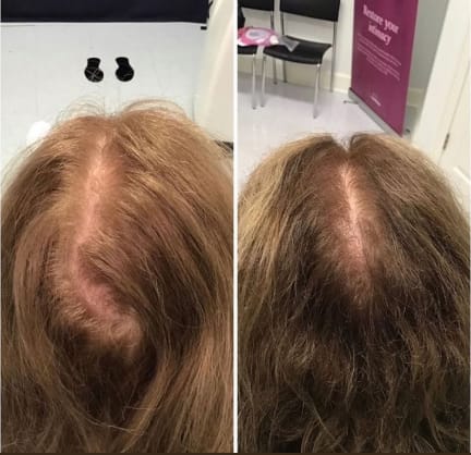 C B. review of Women's Progesterone-Balancing Tea image 1 out of 4