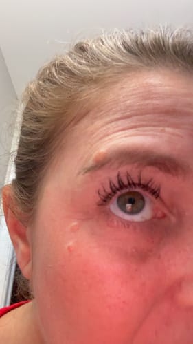 Customer photo review of EYELASH GROWTH SOLUTION