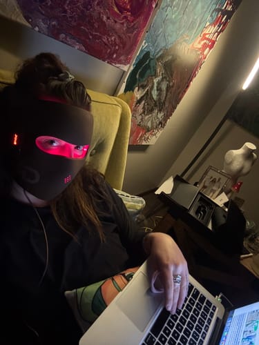 Customer photo review of JOVS 4D Laser Anti-Aging Therapy Mask