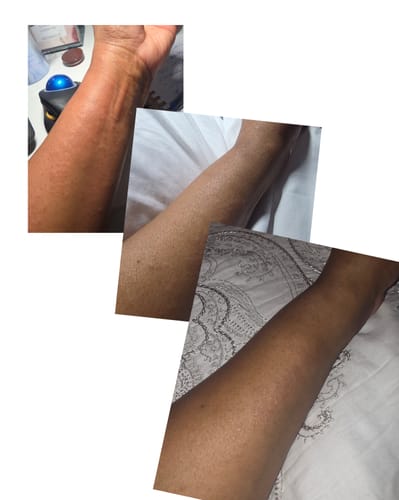 Customer photo review of Extra Strength Sweet Ginger Vapor Rub