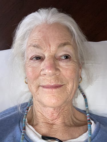 Reviewer's close-up photo showing her facial skin after using the Deep Collagen Cream.