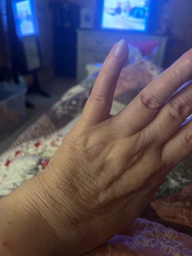 Close-up of a customer's hand looking smooth and nourished after using the Grass Fed Tallow & Honey Balm.