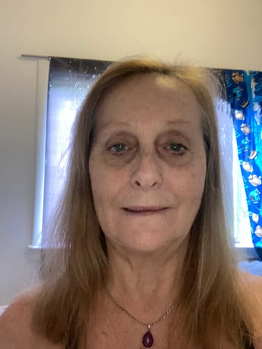 Reviewer's selfie showing fewer wrinkles and a lifted jawline after using the Seranova Micro Infusion System.