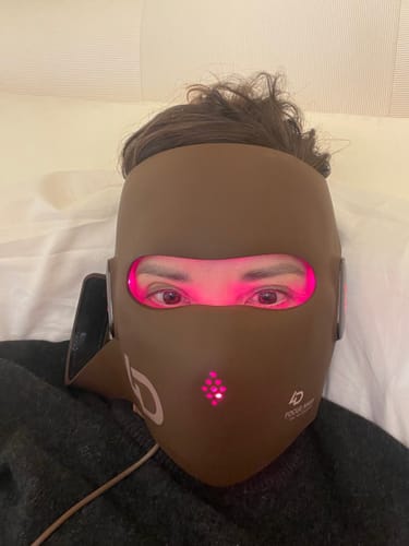 Customer photo review of JOVS 4D Laser Anti-Aging Therapy Mask