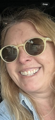 Customer showing her skin with some dark patches before using the Grass Fed Tallow & Honey Balm.