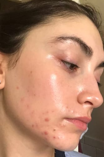 عائشة م. review of Liver-Protecting & Detox Tea image 1 out of 4