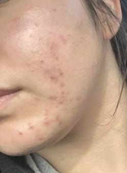 لينا ح. review of Liver-Protecting & Detox Tea image 1 out of 4