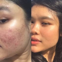 دينا م. review of Skin-Brightening & Spot-Removing Tea image 1 out of 4