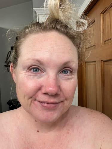 Reviewer's before photo, showing their face with some visible redness before using the tallow balm.