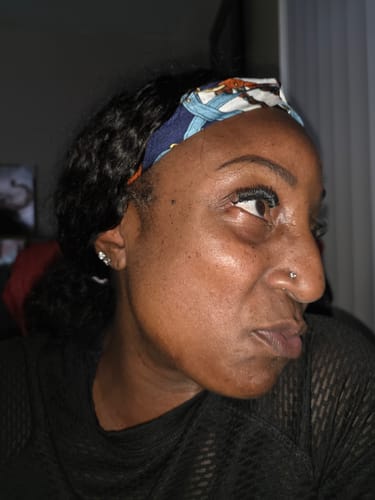 Patrice L. review of Dark Spot Roller 50 ml (inner thighs and underarms) image 1 out of 1