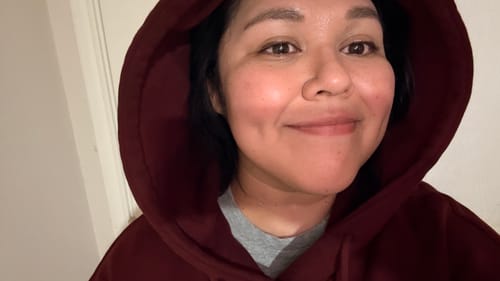 Customer photo review of Oversized Hoodie
