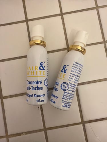 Customer photo review of Fair and White Original Dark Spot Remover 30 ml / 1 fl oz