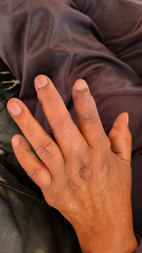 Customer photo review of Uric Acid Support