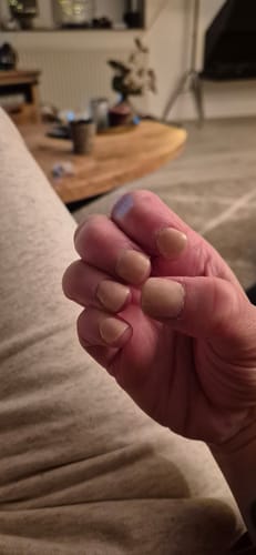 Customer photo review of Glowdip Alles-in-één Manicure Set