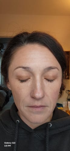 Customer photo review of EYELASH GROWTH SOLUTION