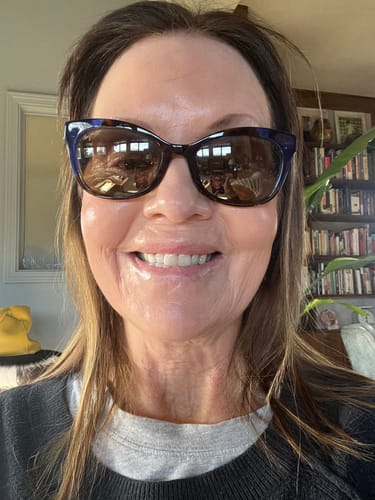 Customer photo review of Free JOVS Full-Face Micropoint Anti-Wrinkle Set