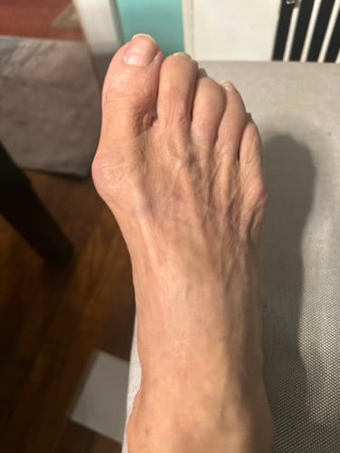A customer's foot, shown in their review of the soothing Mama Bear Nerve Relief Lotion.