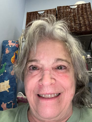 Customer photo review of REORDER-Premium Upper and Lower Retainer Set