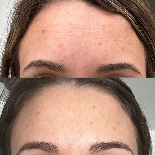 Customer photo review of The Complete System for Mature Women’s Skin