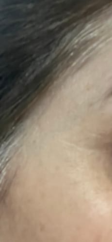 Customer photo review of Multi Peptide Essence 150ml (lids are slightly scratched)