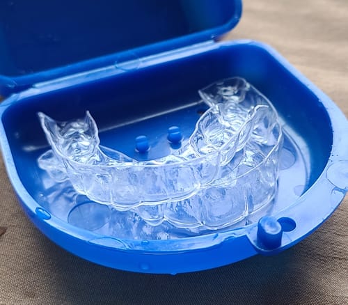 Customer photo review of Premium Upper and Lower Retainer Set