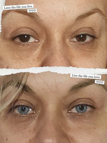 Customer photo review of Elfie Blue Colored Contact Lenses
