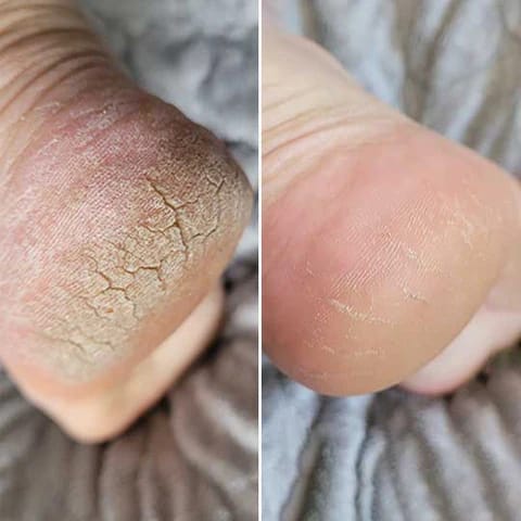 Customer photo review of Nuvé