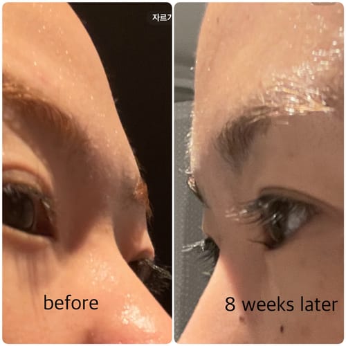Customer photo review of LASH SERUM