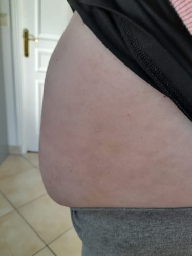 Customer photo review of Baume CBD - 1342MG