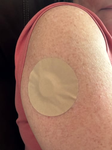 Customer photo review of Skin Grip MAX Dexcom G7 & Stelo Patches - 10 Pack