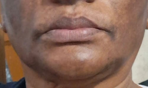 Customer photo review of Axis-Y - Peeling éclat rénovateur PHA - 50ml