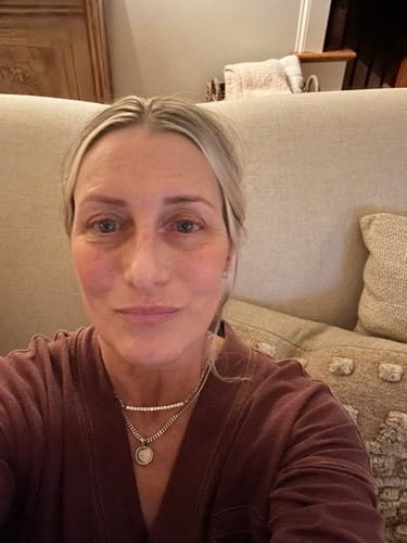 Customer photo review of ECZPRO - PROBIOTICS FOR ECZEMA, 13 STRAINS, 20 BILLION CFU
