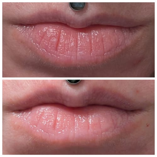 Customer photo review of Glov Micro Infusion System