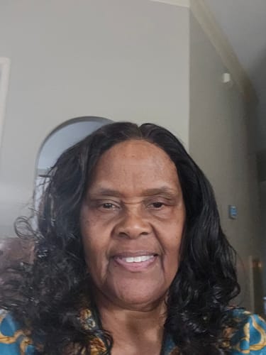 Customer photo review of Lace Glue