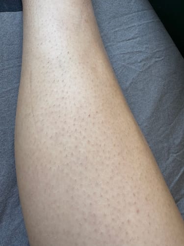Customer photo review of (Free Gift, Not Sold Separately) JOVS DIARY Sodium Hyaluronate Soothing Gel
