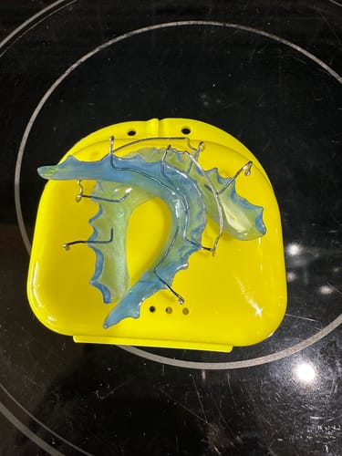 Customer photo review of Hawley Orthodontic Retainer, Buy One Get One 30% Off BOGO! Use code: HAWLEY30
