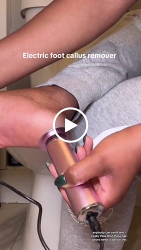 Customer video review of The Original Electric Callus Remover