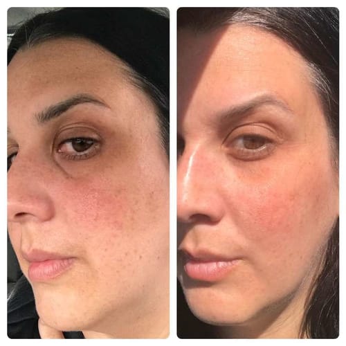 Customer photo review of Noirwild™ Turmeric Soap