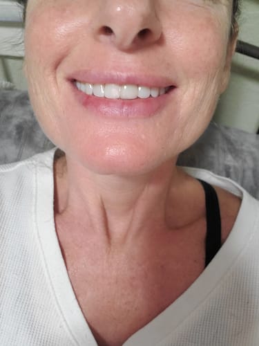 Customer photo review of File Your Smile (A Digital Copy of Your Impressions For Future Replacement Products)