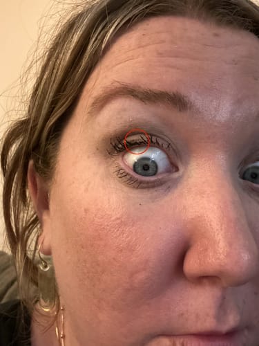 Customer photo review of EYELASH GROWTH SOLUTION